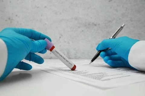 Liver Function Test. Laboratory worker holding tube with blood sample while.. Stock Photos