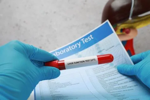 Liver Function Test. Laboratory worker holding tube with blood sample and f.. Stock Photos