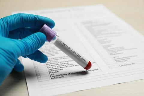 Liver Function Test. Laboratory worker with tube of blood sample and form a.. Stock Photos