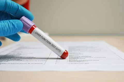 Liver Function Test. Laboratory worker with tube of blood sample and form a.. Stock Photos