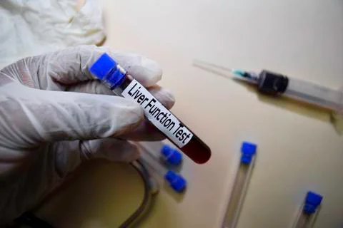 Liver Function Test text on Sticky Notes. Top view isolated on office desk. Stock Photos