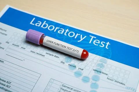 Liver Function Test. Tube with blood sample and laboratory form on wooden tab Stock Photos