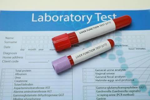 Liver Function Test. Tubes with blood samples and form on table, above view Stock Photos