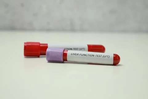 Liver Function Test. Tubes with blood samples on white table Stock Photos