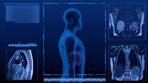 Liver MRI multi Stock Footage 265473344