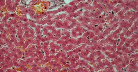 Liver with parasites in roebuck Video stock 139313425