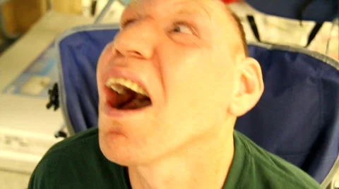 Living with microcephaly 1 Stock Footage 769843