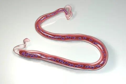 Loa loa, a roundworm nematode, the causative agents of Loa loa filariasis Stock Illustration
