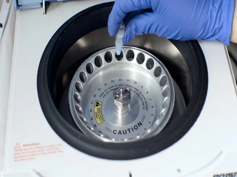 Loading the centrifuge Vídeo Stock 75766550