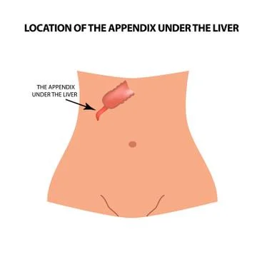 Location of the appendix under the liver. The appendix under the liver Illustrazione stock