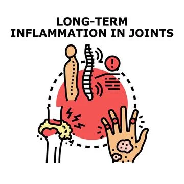 Long term inflammation in human joints concept Stock Illustration