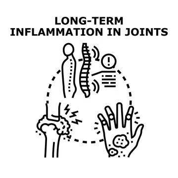 Long term inflammation in human joints concept Stock Illustration
