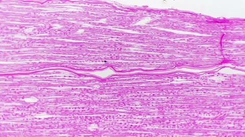 Longitudinal and transversal section of human nerves trunk magnified under light Stock Footage 226838689