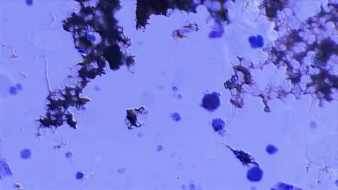 Looking Through Microscope At biological organism At Microbiology Laboratory Stock Footage 154742695