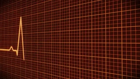 Loopable clip of a healthy heart on an EKG Stock Footage 98247351