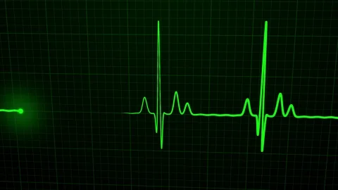 Loopable: Green 3D EKG/ECG Cardiogram Oscilloscope Monitor Heartbeat Line Chart Stock Footage 124942491