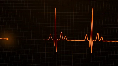 Loopable: Orange 3D EKG/ECG Cardiogram Oscilloscope Monitor Heartbeat Line Chart Stock Footage 125453718