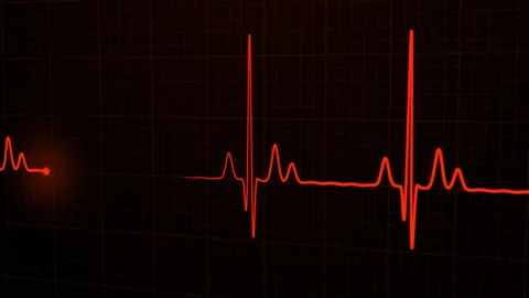 Loopable: Red 3D EKG/ECG Cardiogram Oscilloscope Monitor Heartbeat Line Chart Video stock 157567960