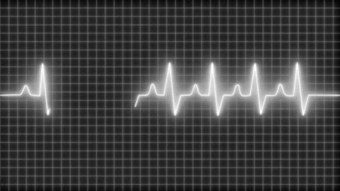 Looping Animation of Neon Pulse Trace Signal Heartbeat Monitor 動画素材 314652738