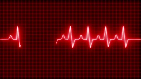 Looping Animation of Neon Pulse Trace Signal Heartbeat Monitor Stock Footage 314652761