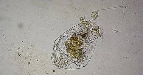 Loricate rotifer in slow motion showing ... | Stock Video | Pond5