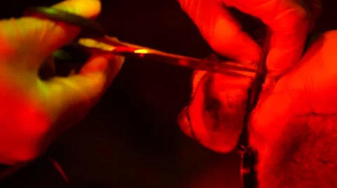 Loris - capture and release Stock Footage 68528886