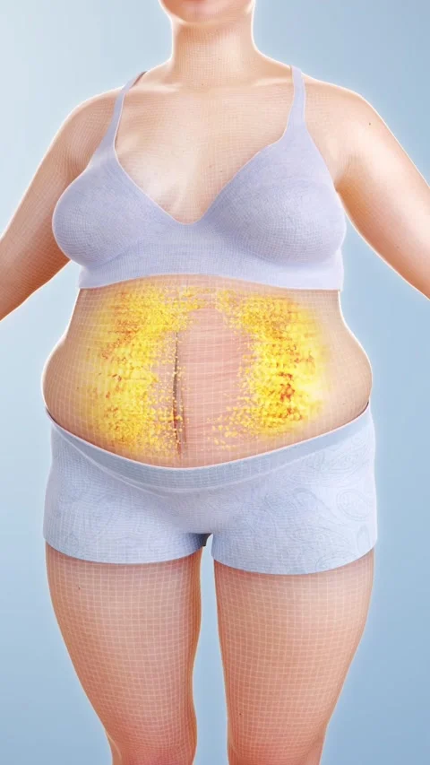 Lose weight by burning belly fat. Female fitness 스톡 동영상 344102413