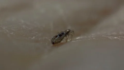 Louse skin macro Видео 90542324