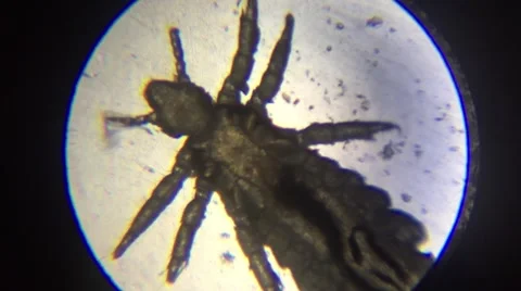 Louse under microscope view Stock Footage 67273047