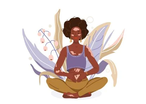 Love yourself with problem vitiligo skin vector background. Self-care body Stock Illustration