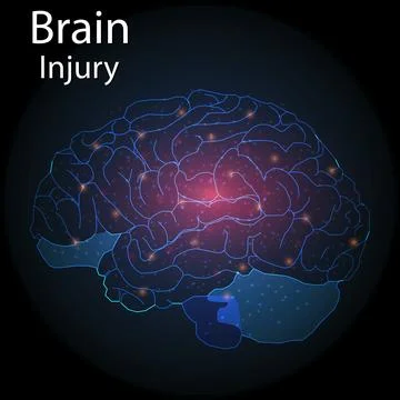 Low poly brain injury or Artificial intelligence concept, Low poly abstract d Stock Illustration