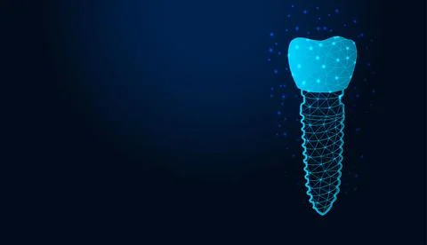 Low poly wireframe dental implant on dark blue background. Stock Illustration