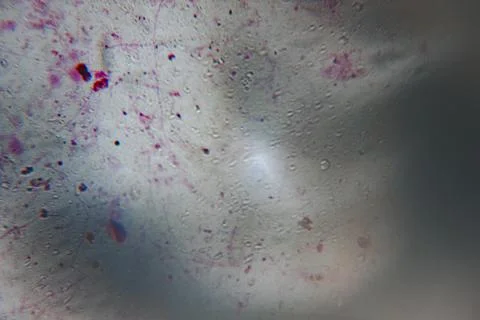 Low-resolution microscopic image showing indistinct cellular structures. Stock Photos