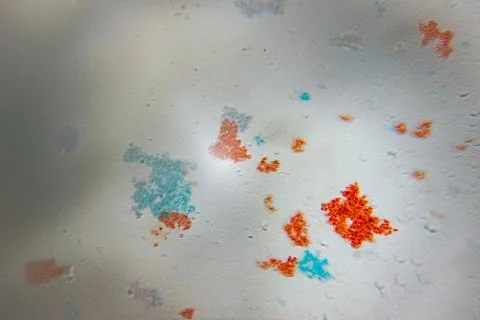 Low-resolution microscopic image showing indistinct cellular structures. Stock Photos
