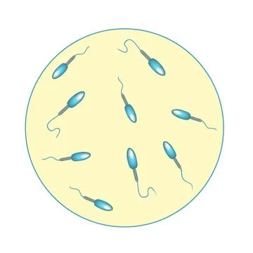 Low sperm count in seminal fluid. Low abundance of sperm in the ejaculate. Male Stock Illustration