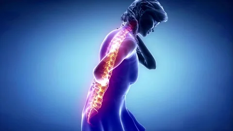 Lower back spine pain Spine Trauma or Arthritis female human bone skeleton x-ray Stock Footage 336580371