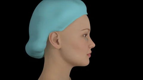 Lower Blepharoplasty Stock Footage 112366747