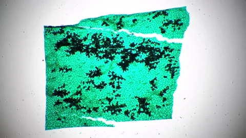 Lower epiderm of leaf of horsebean W.M. under microscope 40x against bright Stock Footage 208853632