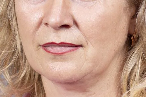 The lower part of the face and neck of an elderly woman with signs of skin ag Stock Photos