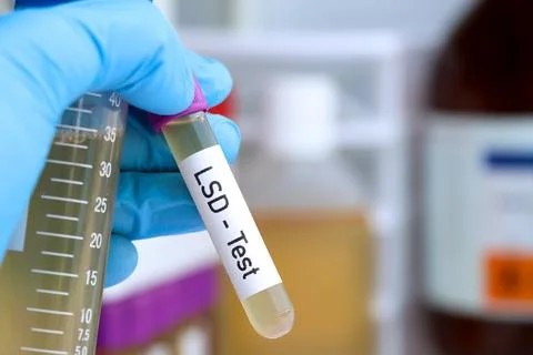 LSD test to look for abnormalities from Urine Photos