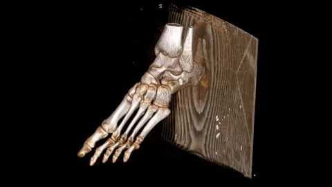 LT Ankle Foot Plain Bone Thin VR movie revealing detailed skeletal anatomy Stock Footage 319123728