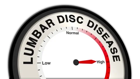 Lumbar disc disease Text or Word Level Low Normal High - Barometer Stock Footage 308595204