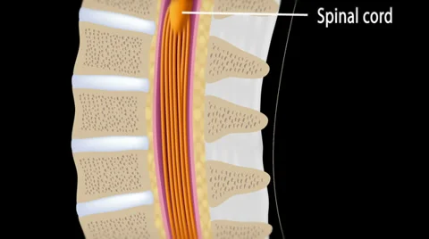 Lumbar epidural injection Vídeos de archivo 37929032