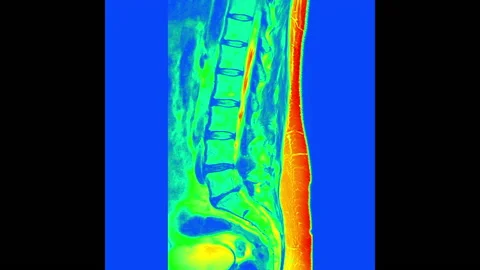 Lumbar MR scan colour. Lumbar magnetic resonance scan, Stock Footage 194631707