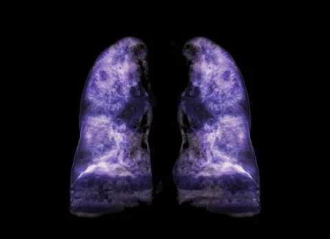 Lung 3D rendering image. Stock Illustration