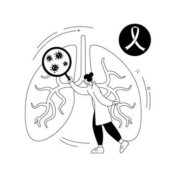 Lung cancer abstract concept vector illustration. Stock Illustration