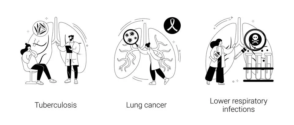 Lung disease abstract concept vector illustrations. Stock Illustration