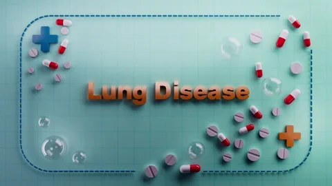 “Lung Disease” title appears on a glowing animation Stock Footage 314153178