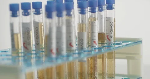 Lung fluid samples of COVID-19 victims in laboratory Stock Footage 127652072