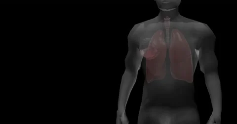 Lung infection by coronavirus Stock Footage 136448722